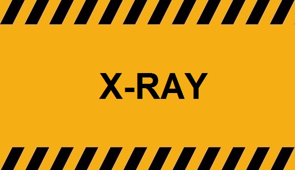 AI X-Ray Dancing Asian Girls No.49